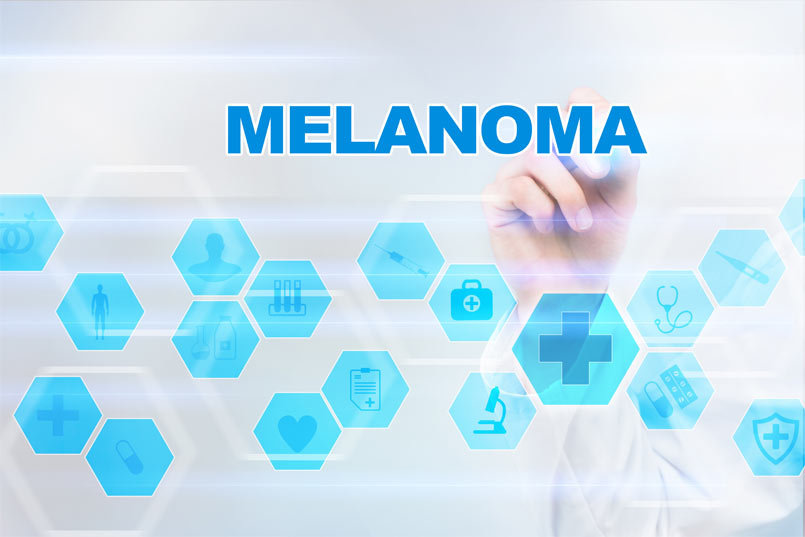 What is Melanoma?