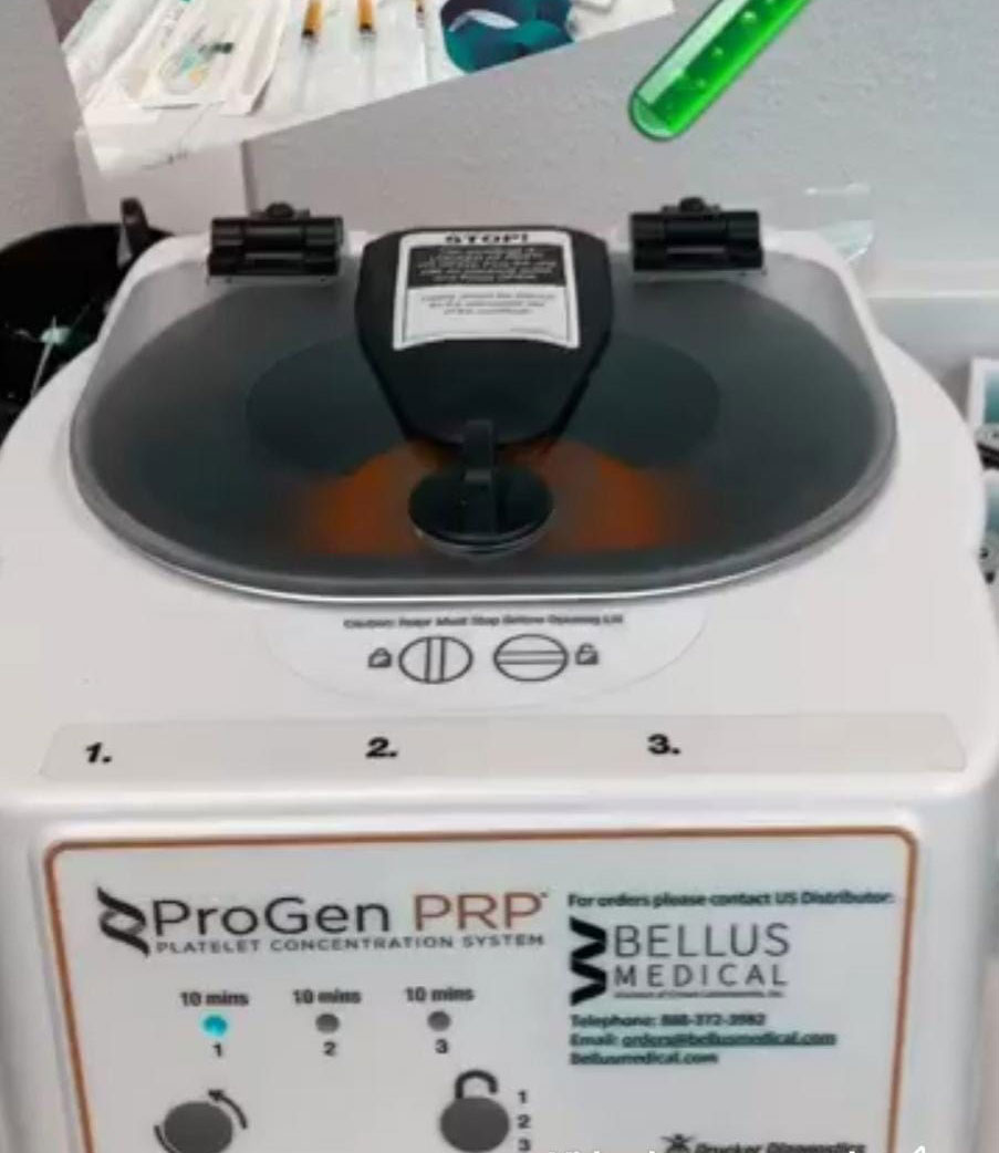 PRP-Treatment-Device