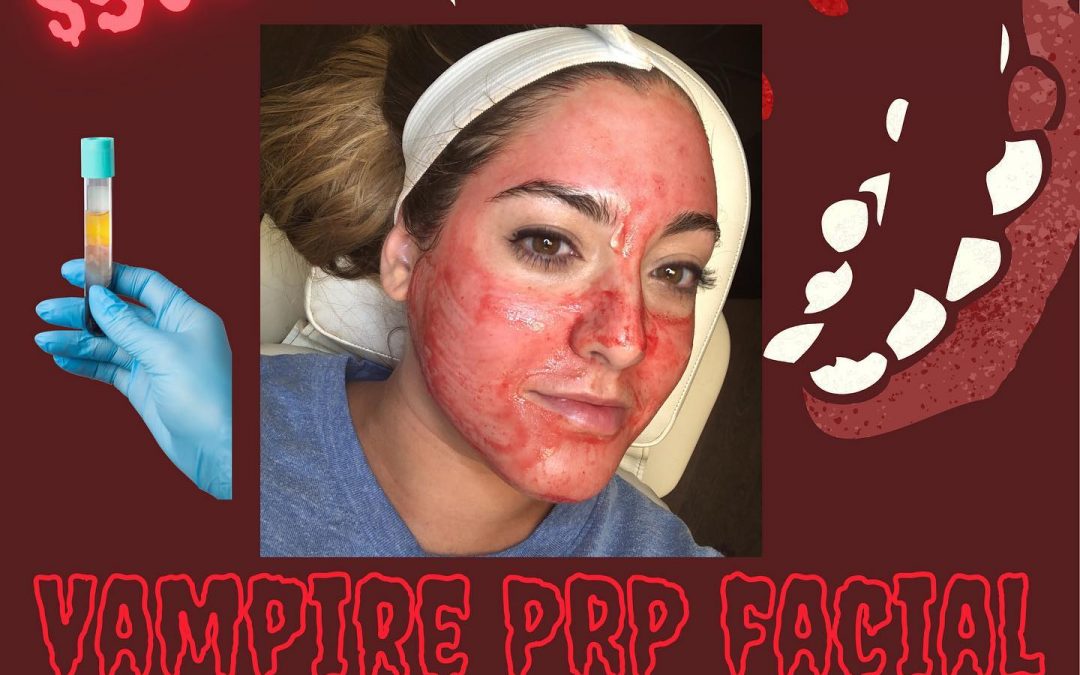 Book your Vampire PRP facial today!
