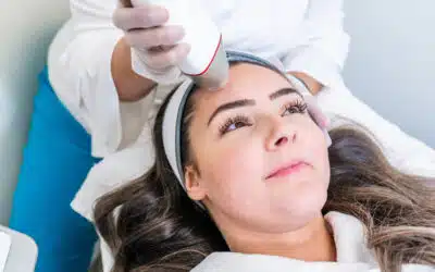 8 Things You Need to Know About Potenza RF Microneedling